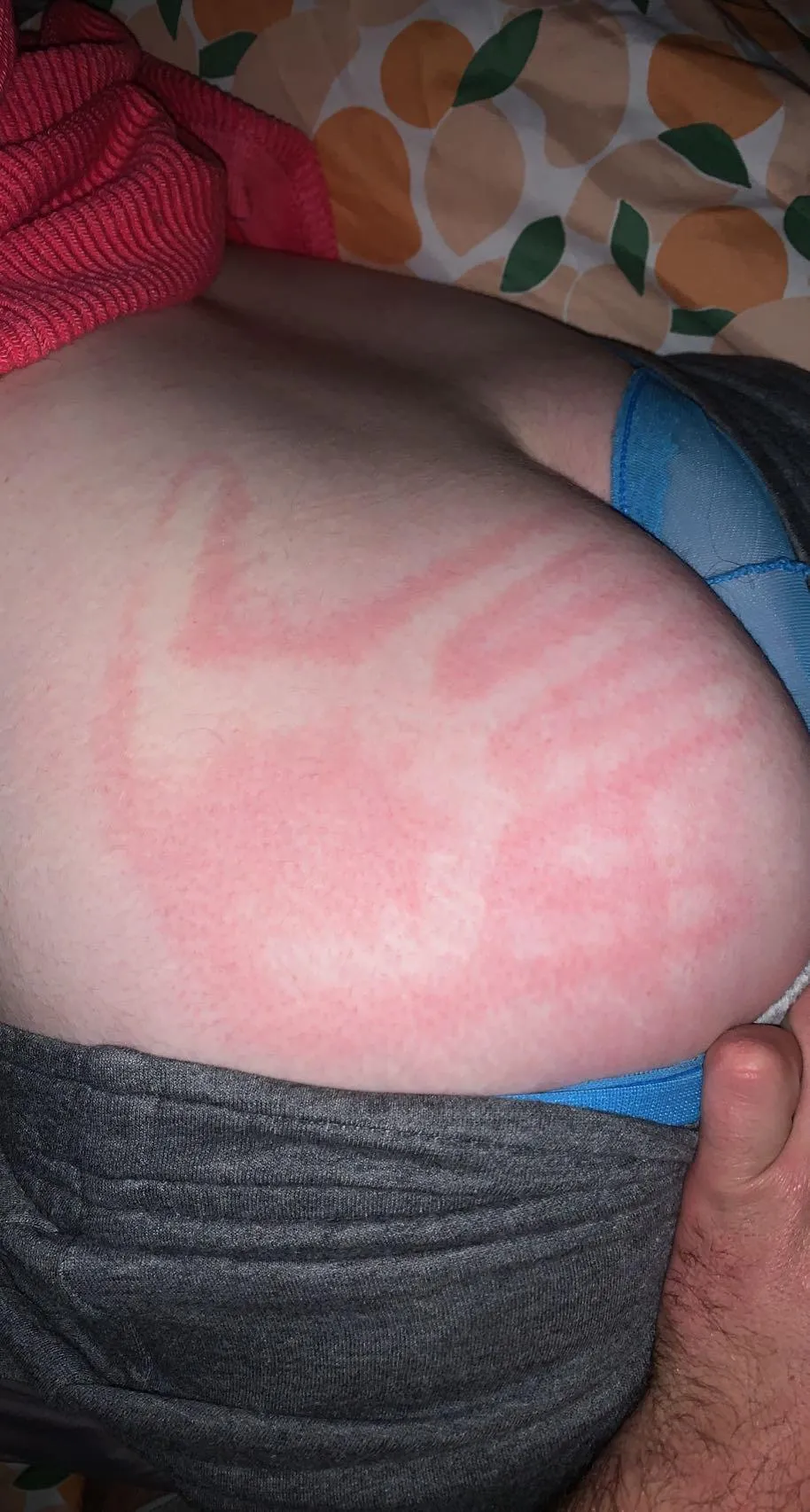 This was through the pants