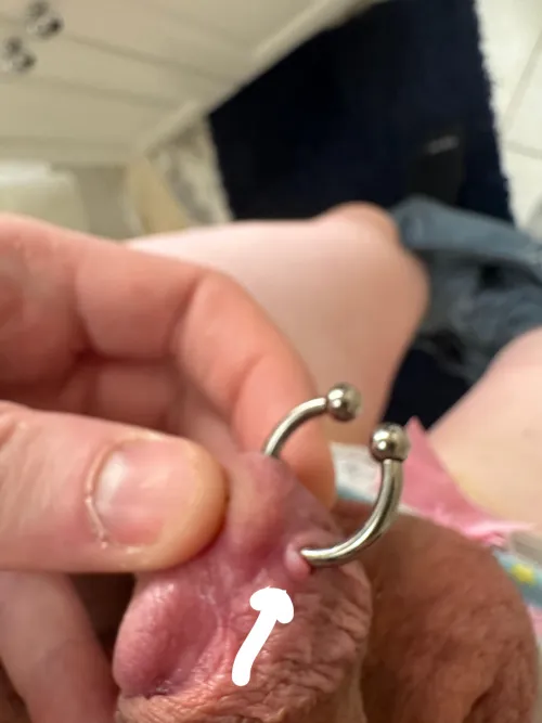 little bit of inflammation — is ok?