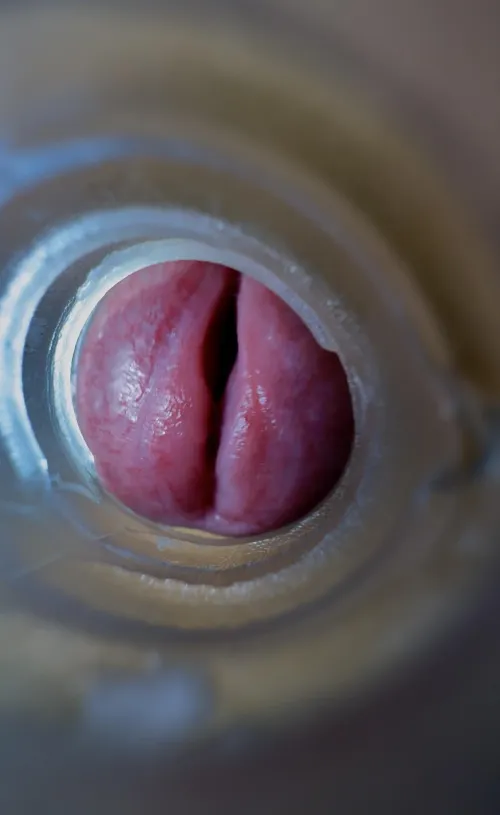 Closeup of my gaped meatotomy.