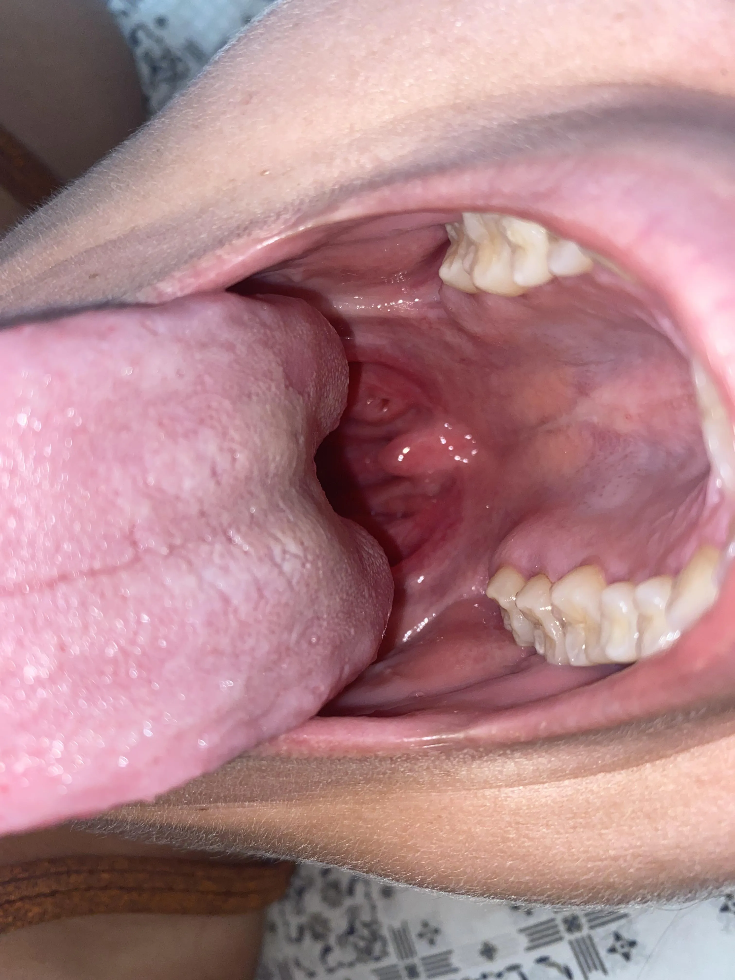 I bet you can't stand to be attached to me for long.