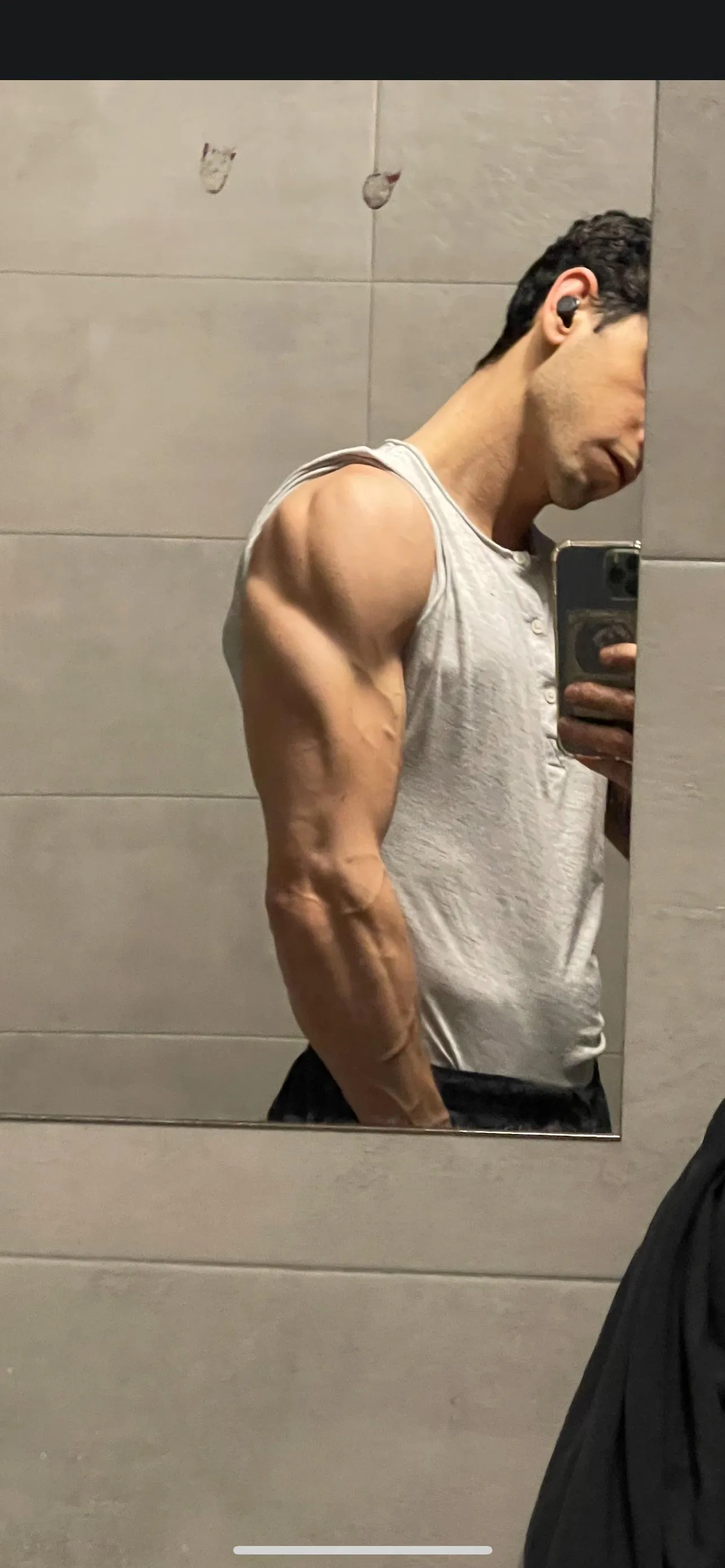 current arm condition