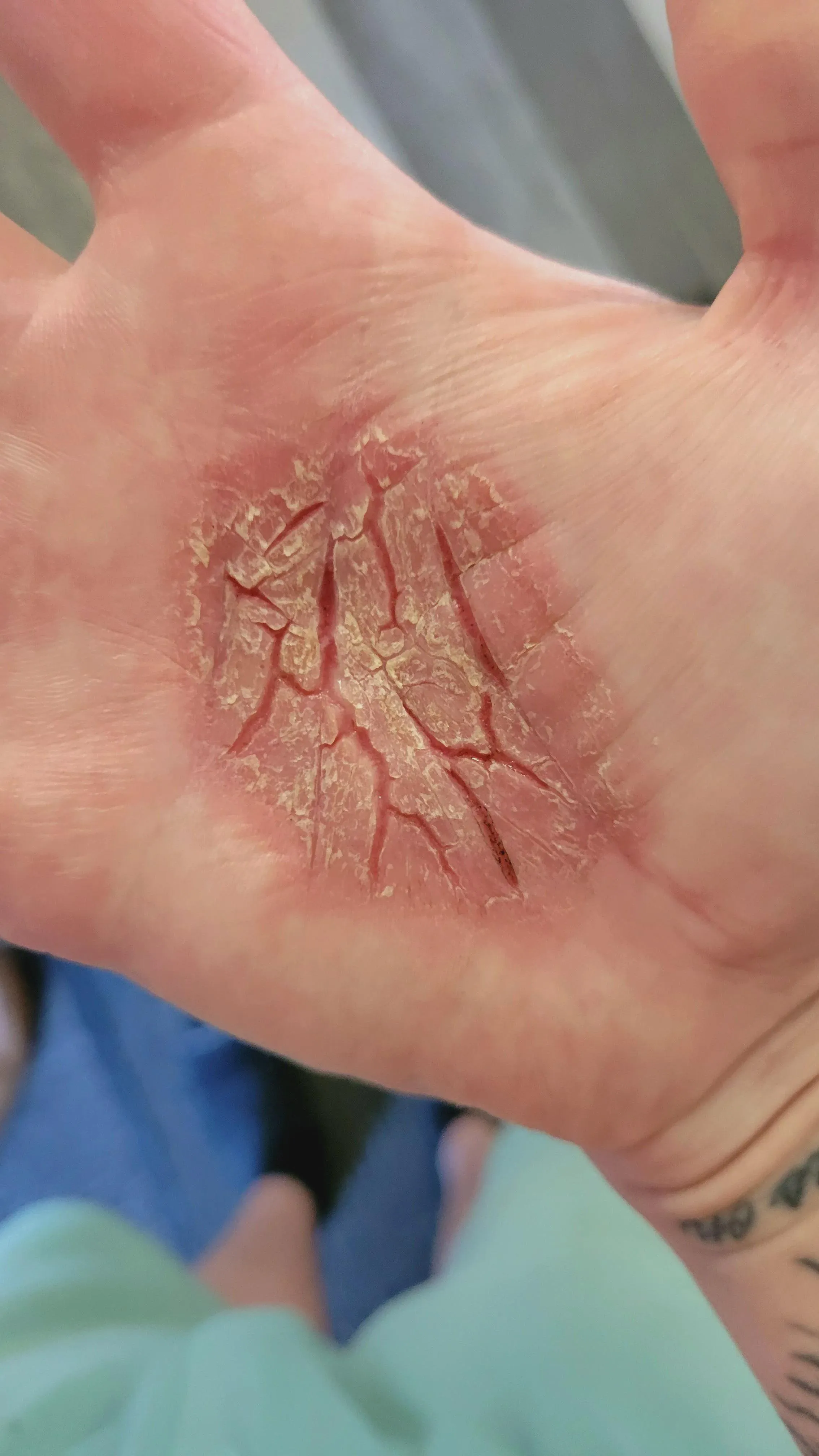 i threw my phone away when i saw this