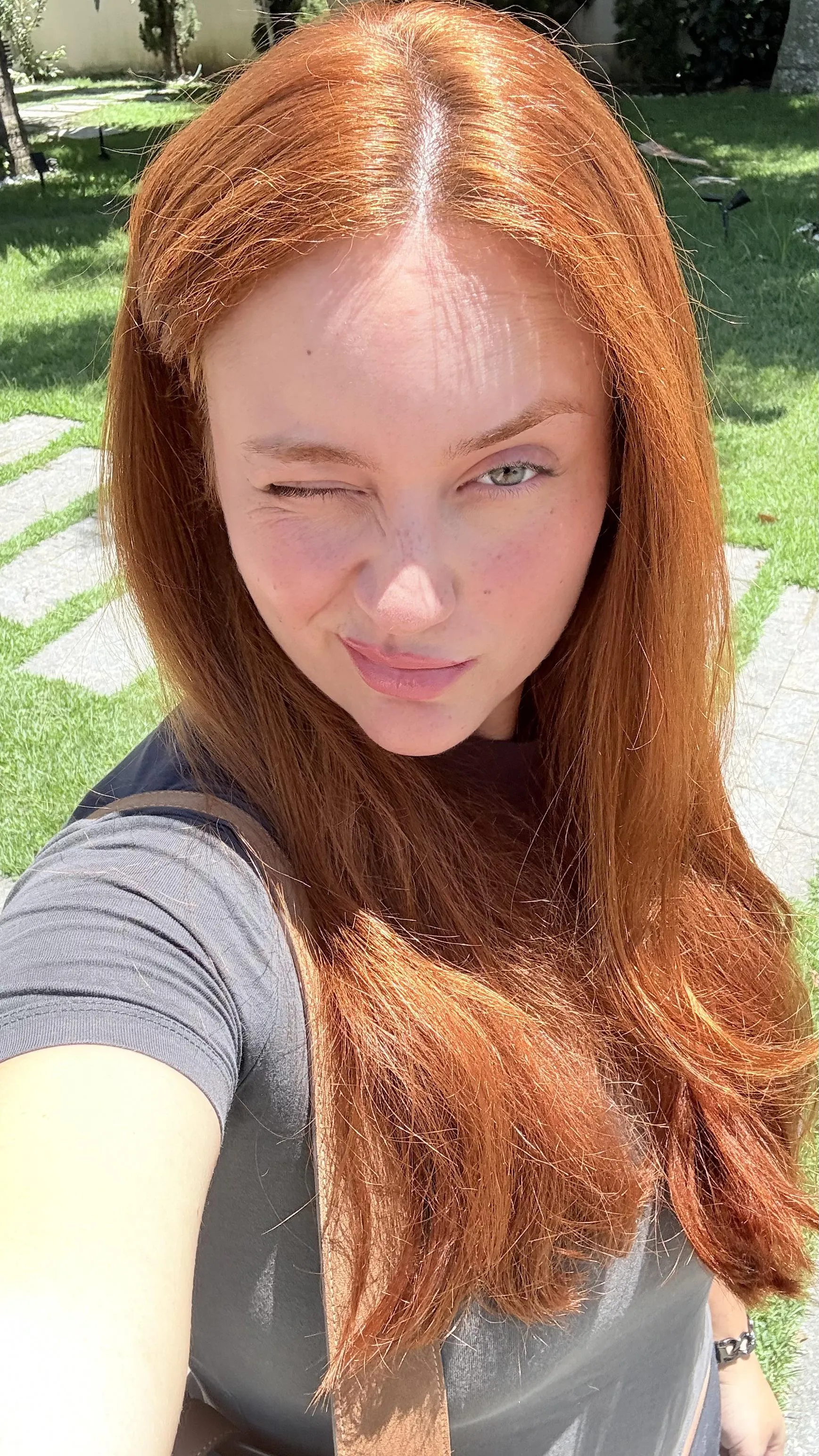 Freckles for a sunny day