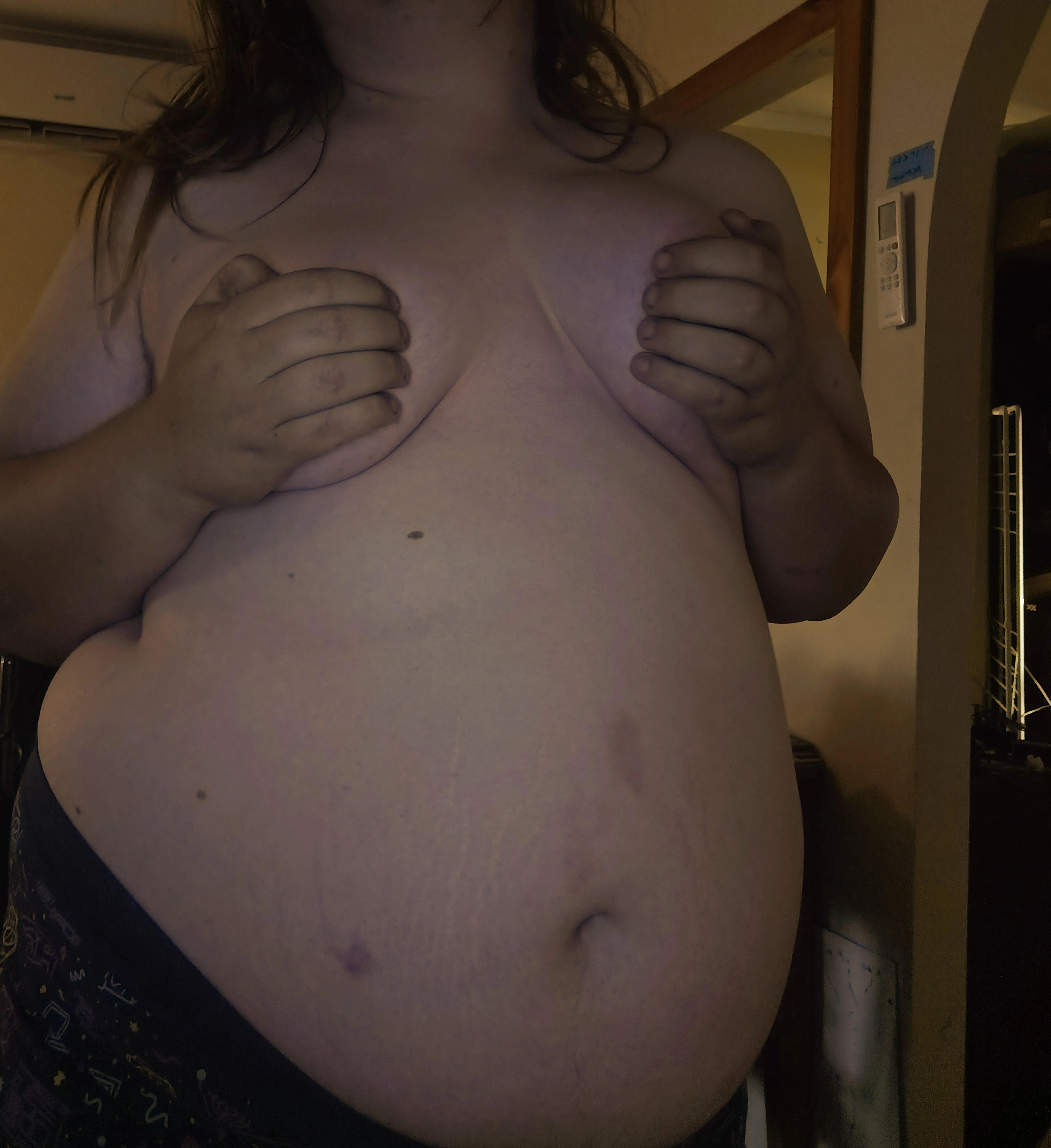 new stretch marks just dropped OMG