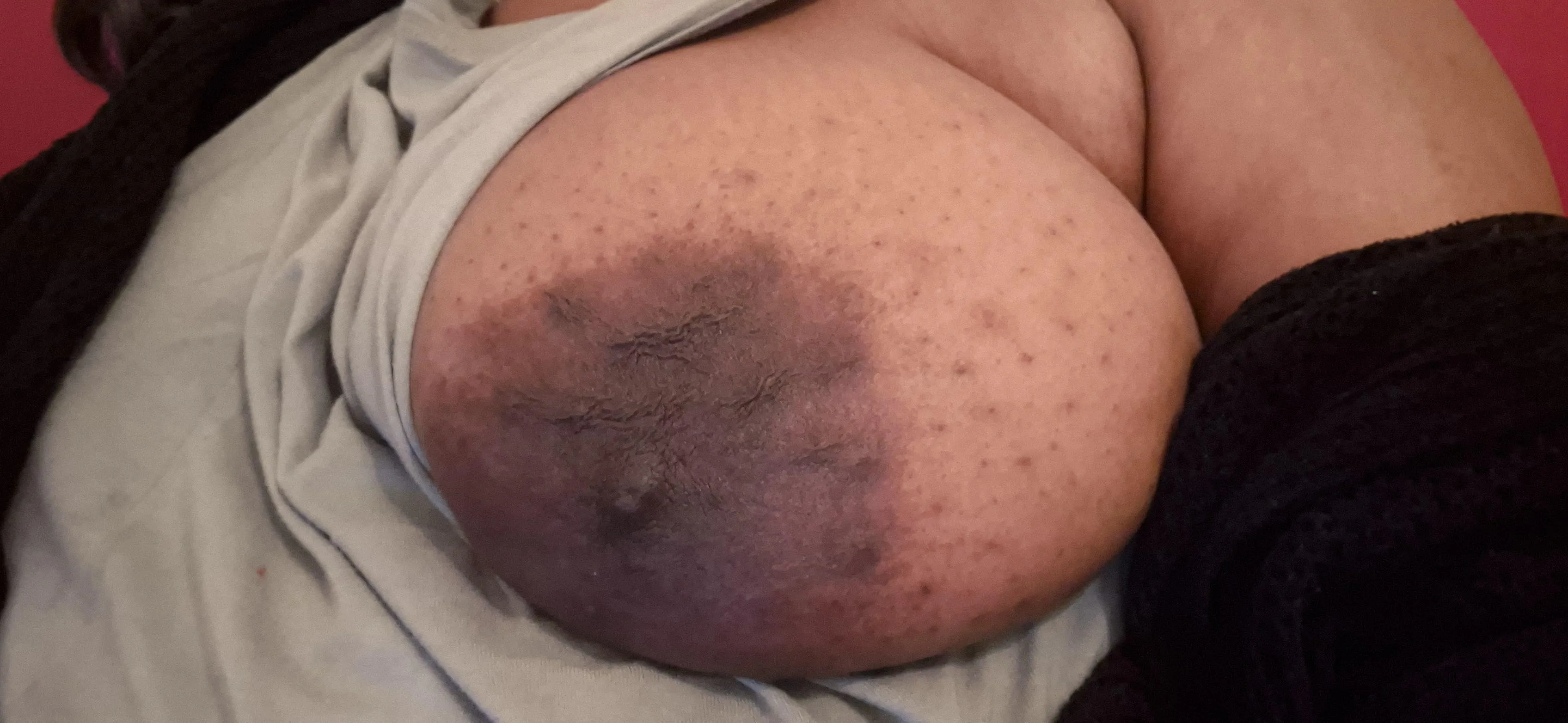 They can't be contained