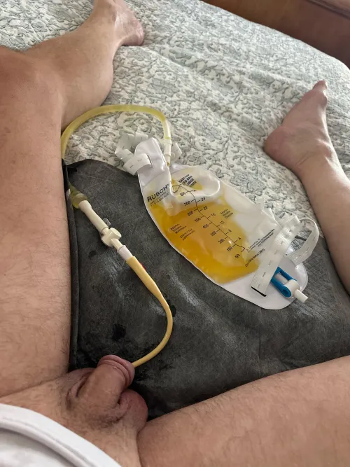 A nice soft small catheter on a lazy Saturday. Not my usual 22 or 24. But feels good still.