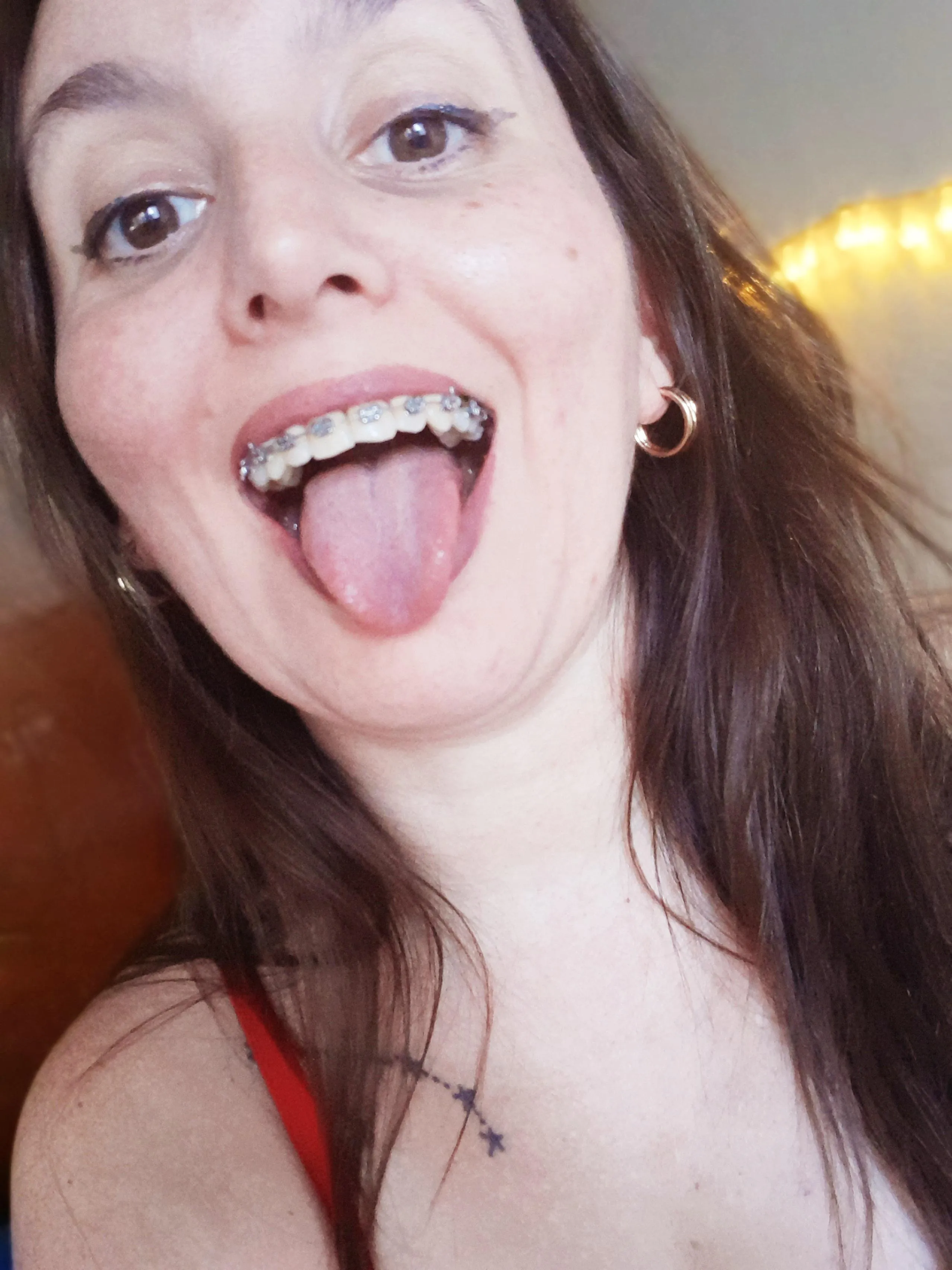 He likes the taste of the metal of the braces?