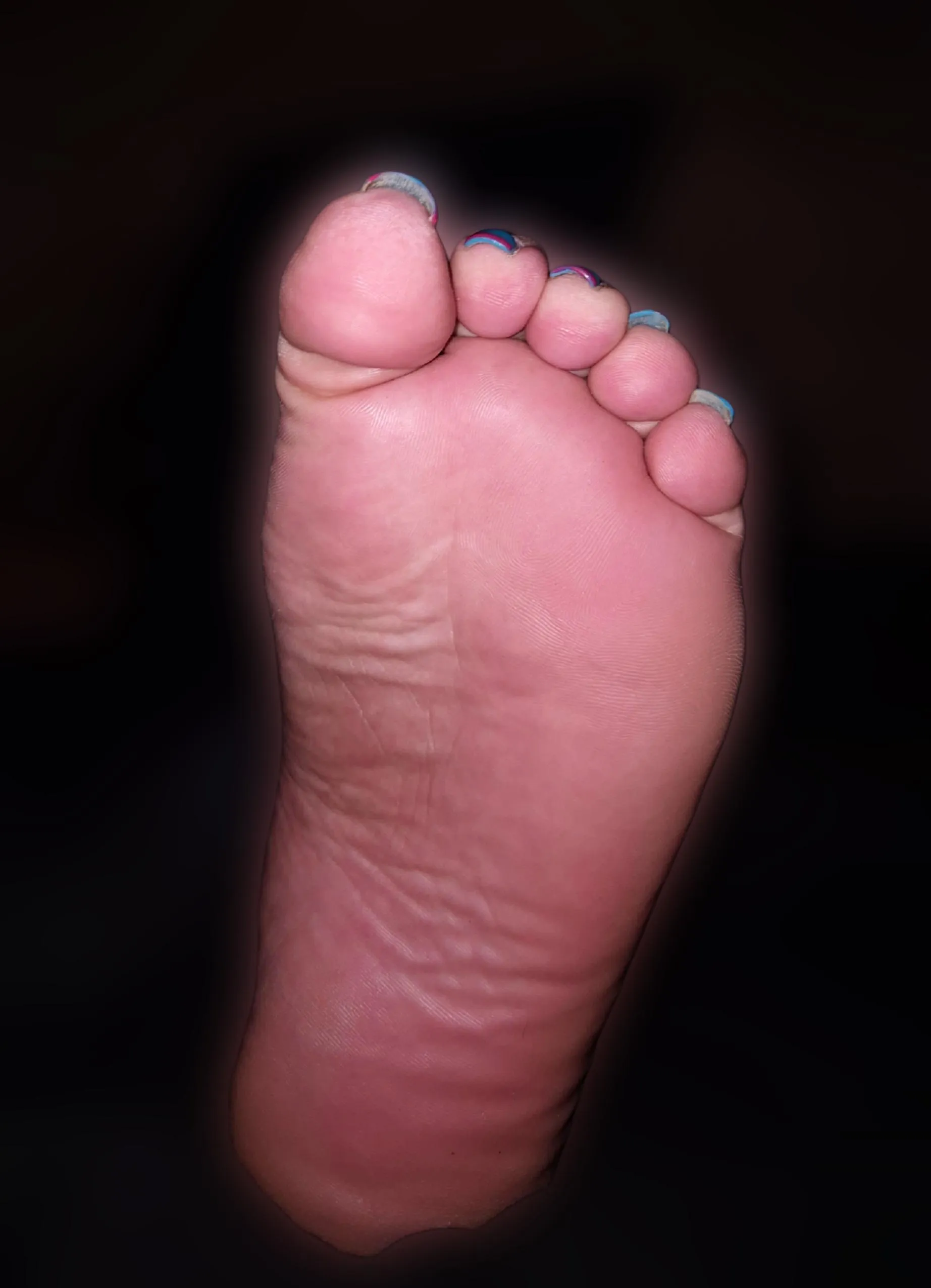 He took this picture of my paralyzed foot while I was sleeping, would you take advantage of me not feeling my foot and do stuff with it? 😈
