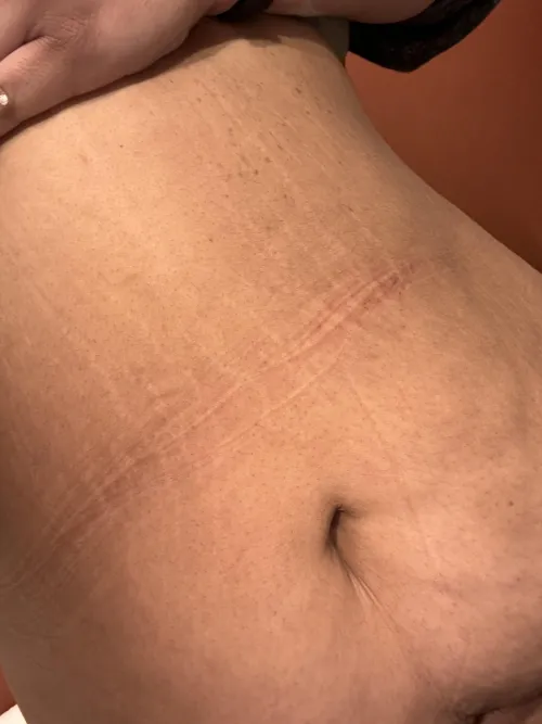 These marks are no joke 😘