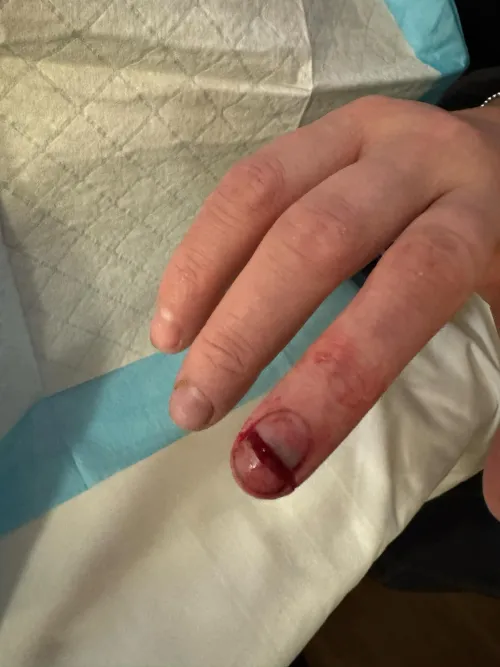 One less nail to cut