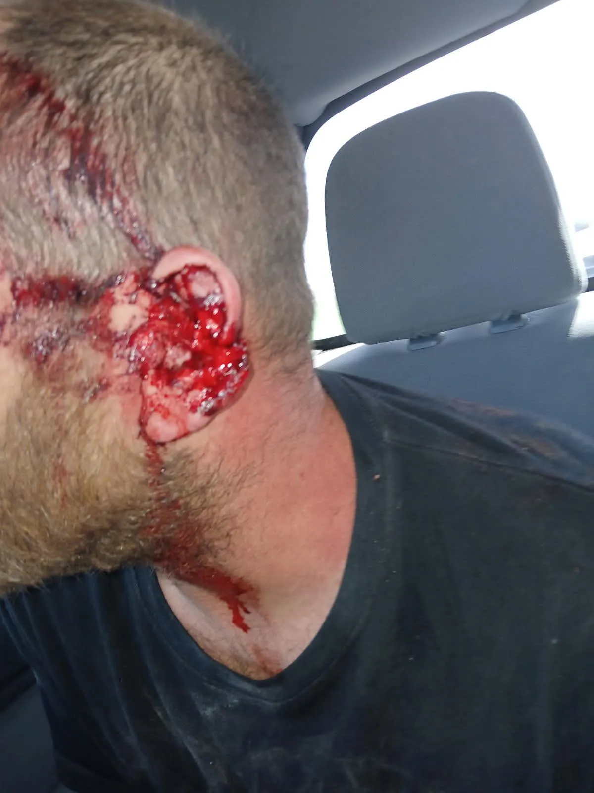 Girlfriends uncle flipped in canam (ear split in half)