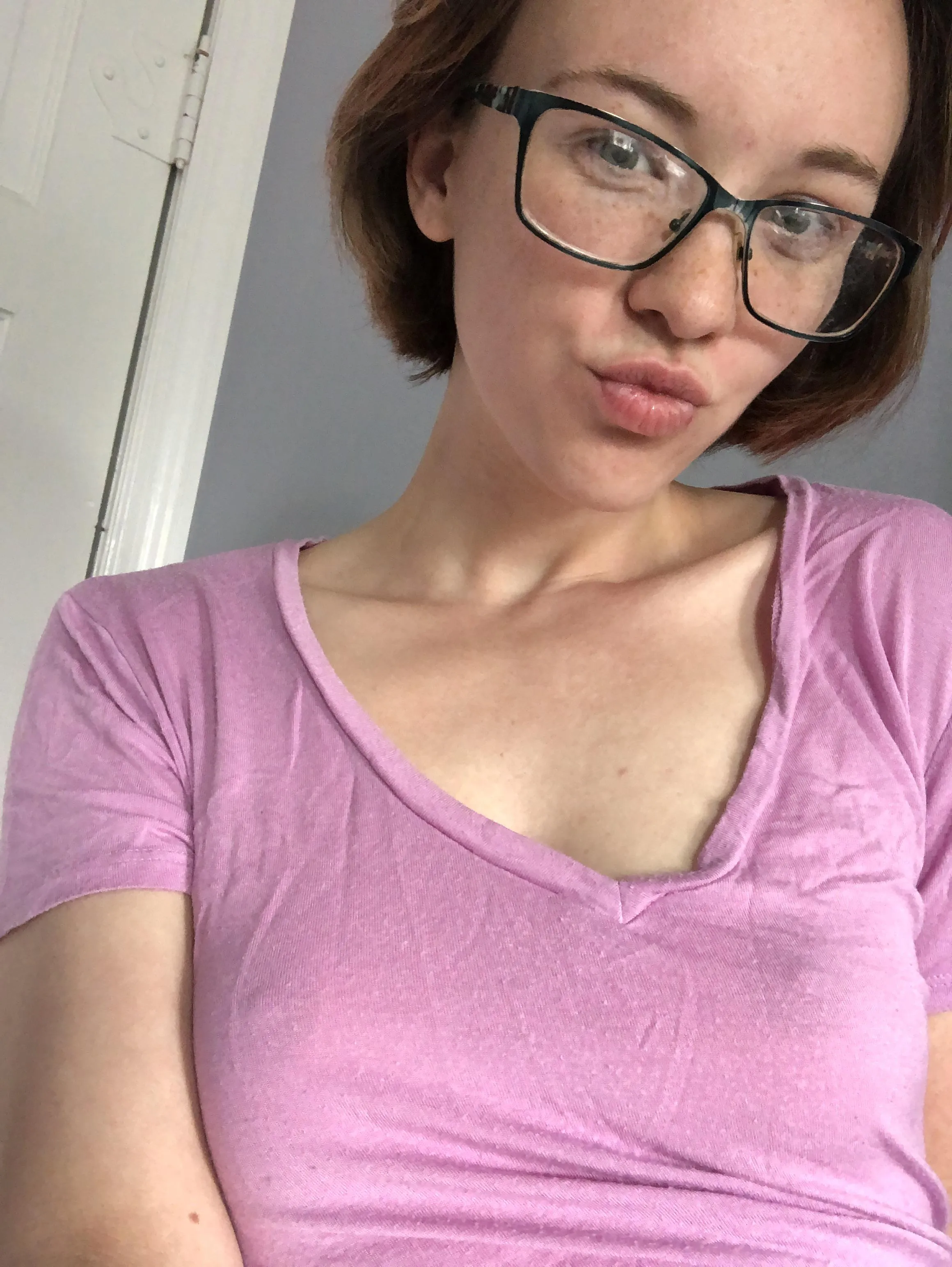 Freckles and lips are naturally drawn to each other