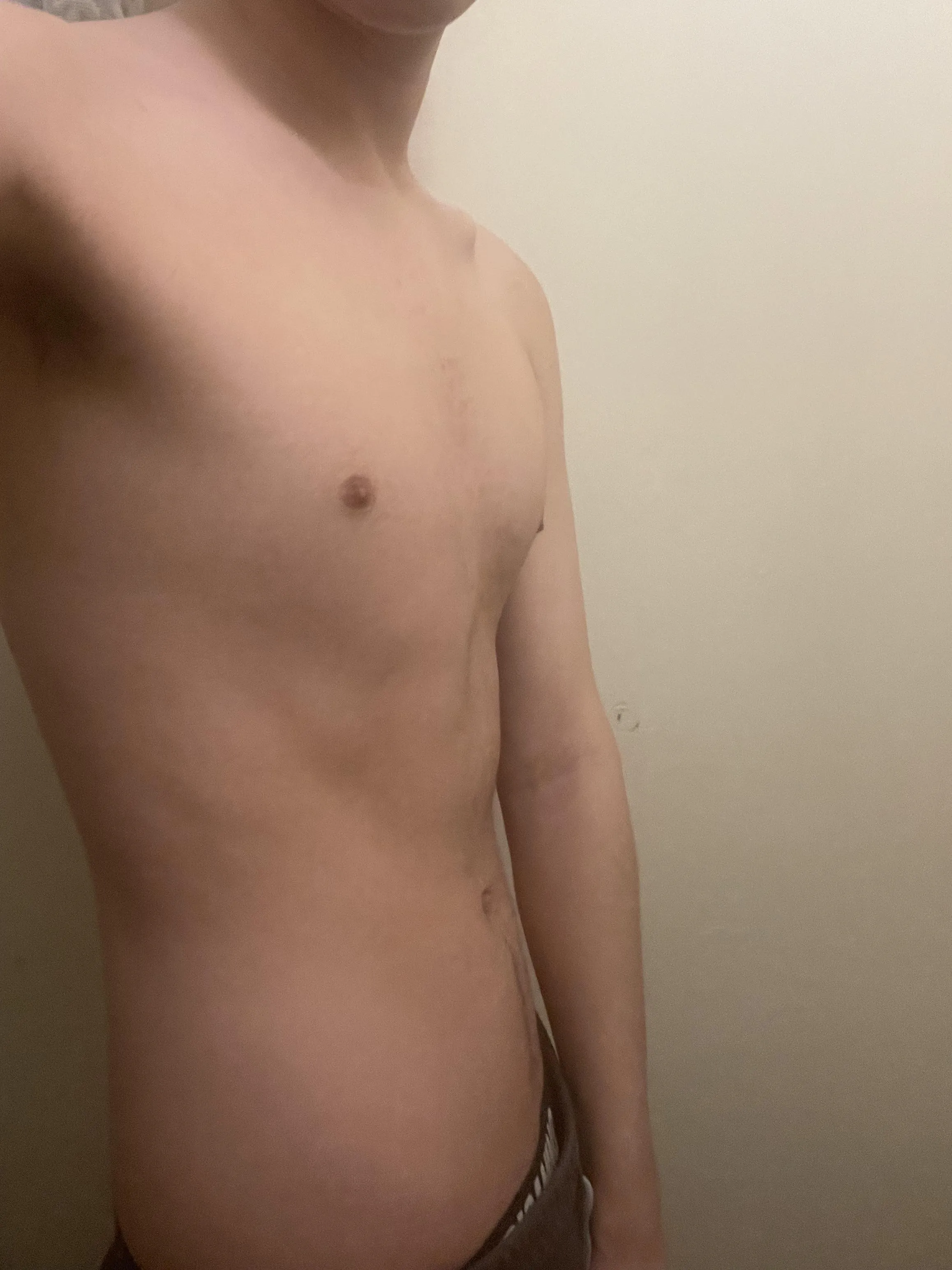 19m wanna compare with bets