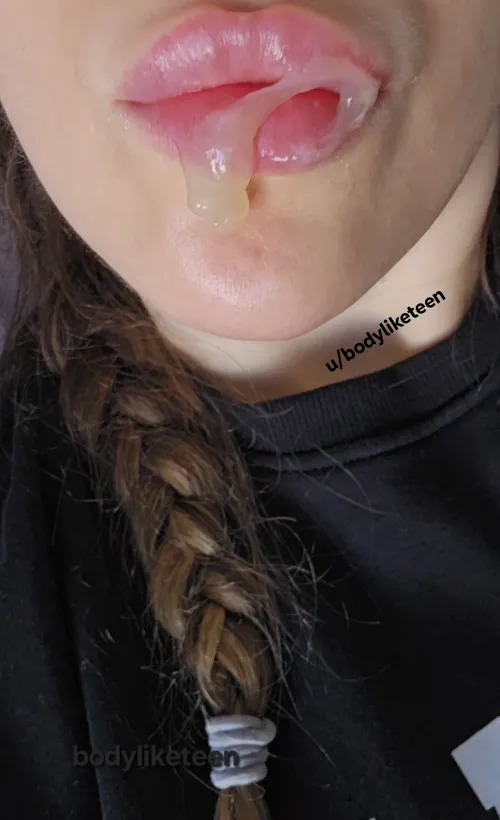 Omg.. look at this huge groon on my mouth