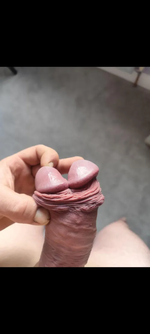 Who also hates regrowth?