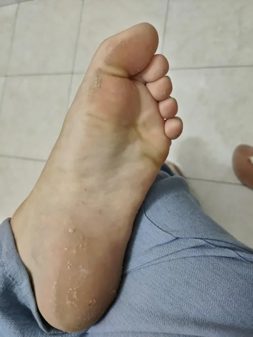 Starting wear sandals, I think my feet need a pedi. Who wants to help me? 😉