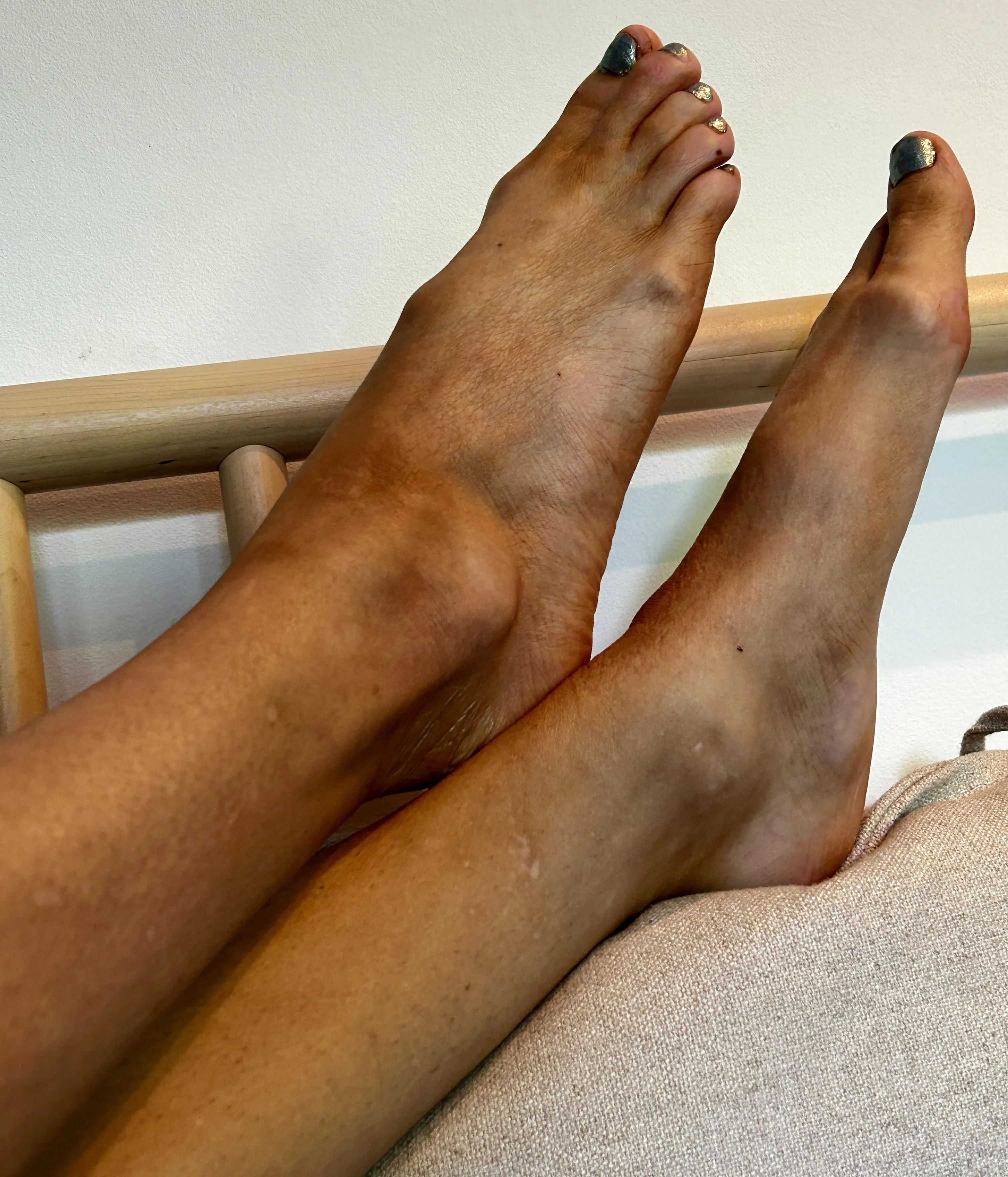 Feeling cute with my flat feet today… any fans of ‘no’ arches out there? 😉💖