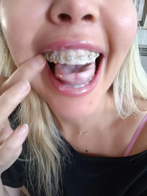 Have you ever got your cock sucked by a slut milf with braces