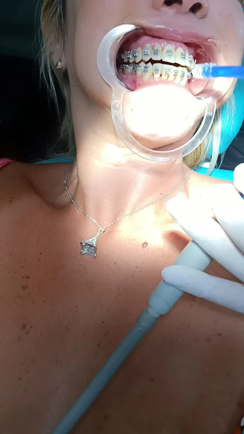 Look how cute metal mouth to fill with cum