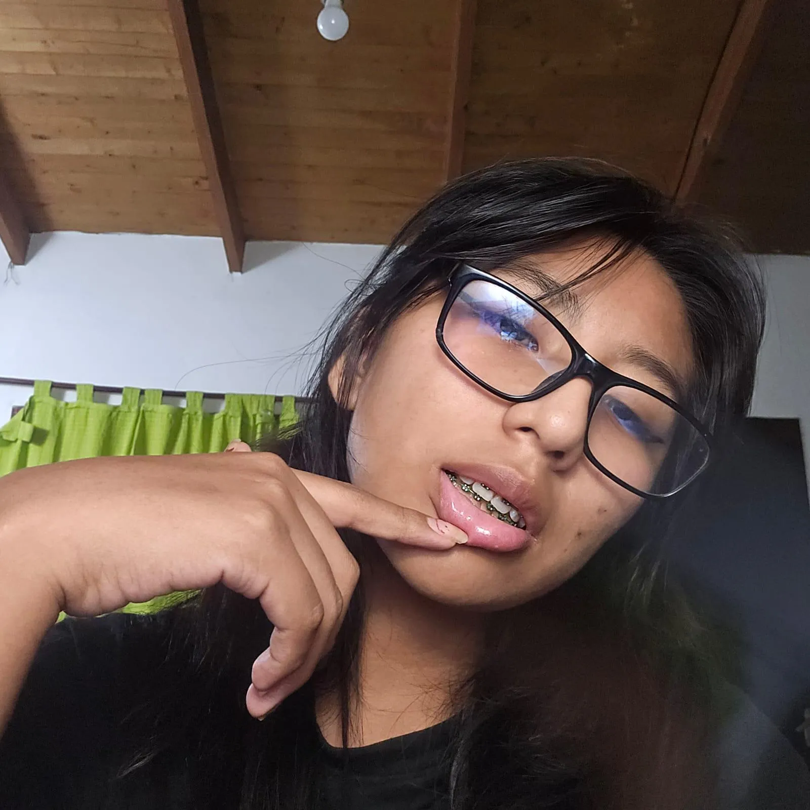 photo before brushing my teeth