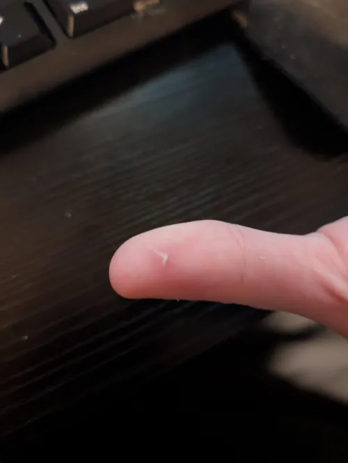 Got this little cut earlier today. Forgot to cover it. Think it's infected?