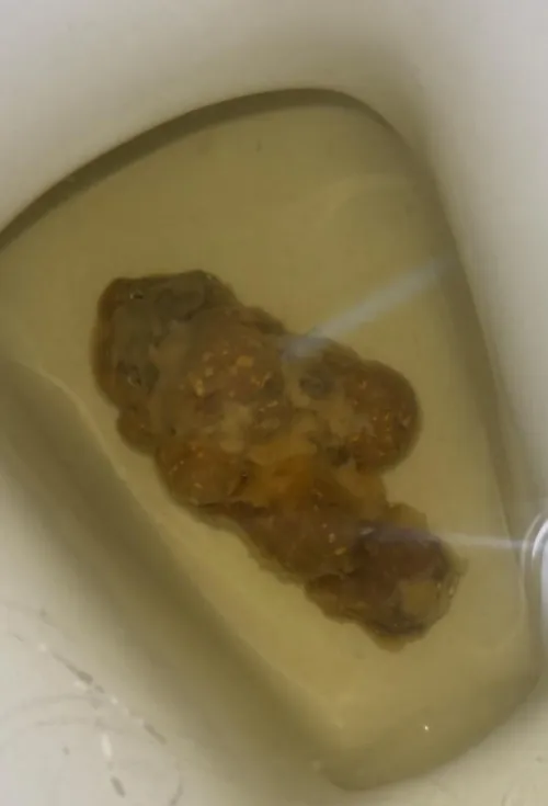 I am have been constipated and finally pooped today. Really worried about how it looks. Advice needed