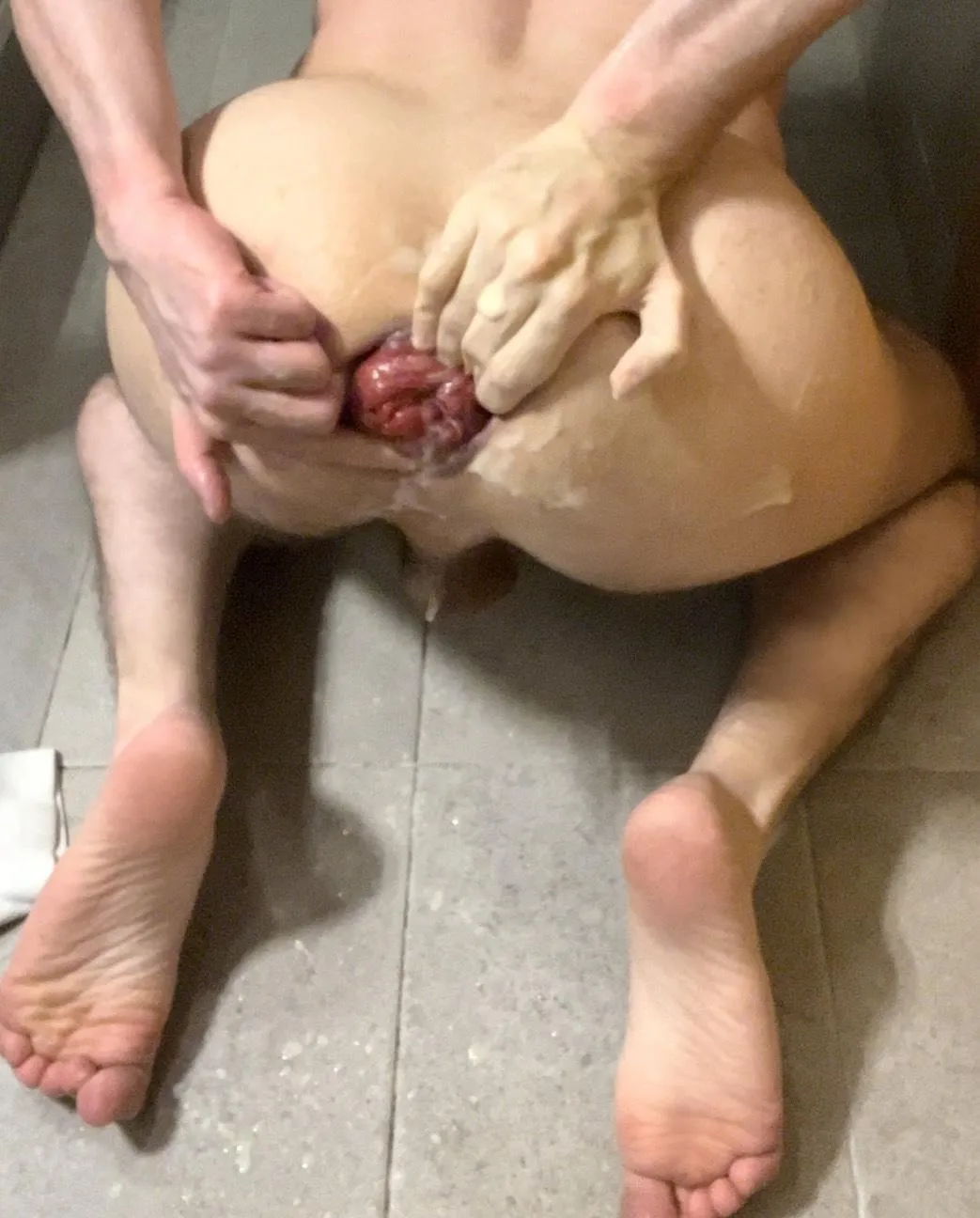 Is my asshole ruined