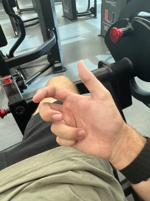 My fingers get stuck in claw position when working out, thinking it could just be dehydration, but I happens to way too often.