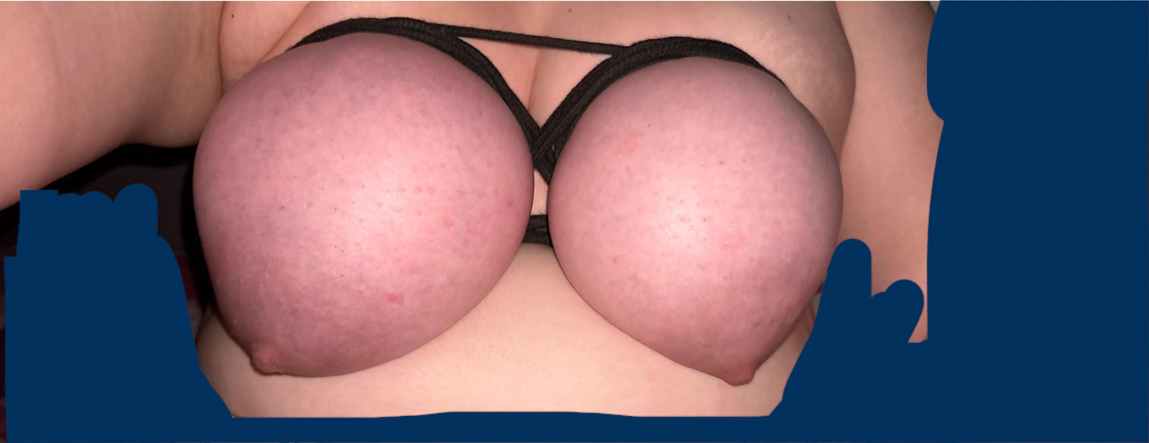 my useless fucking udders all tied up instantly changing colour