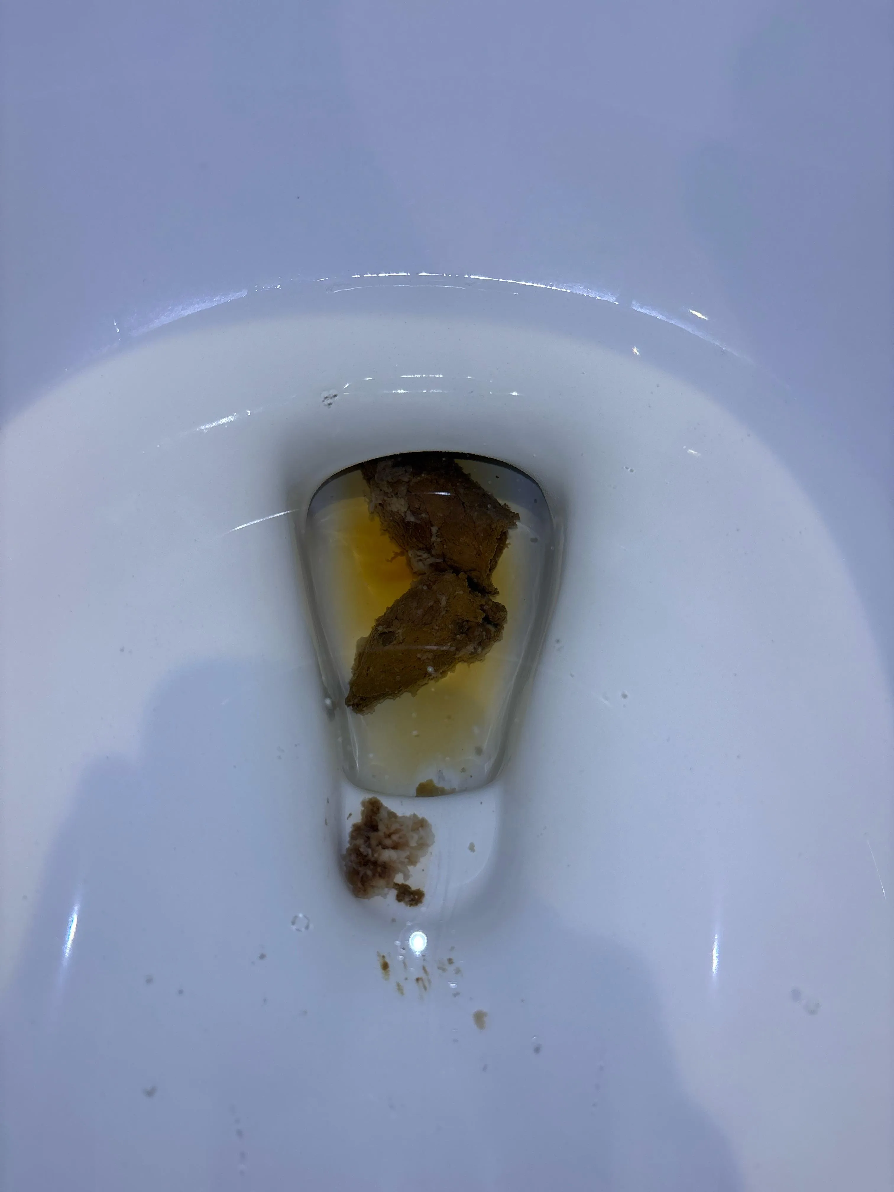 NSFW warning poop. White mucus all over my poops. Parasite test pending.