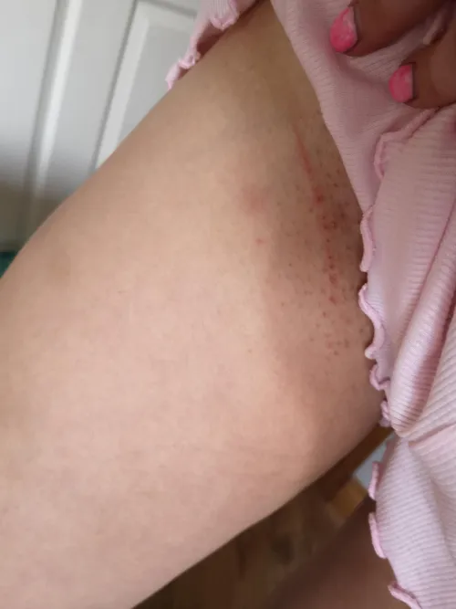 Got cut from my panties being ripped off last night 🫢ow doesn't cut it. Nice sharp stinging reminder