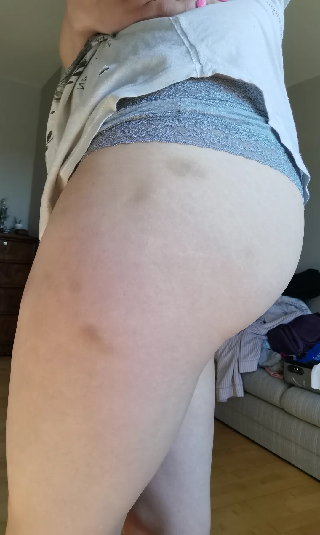 Love seeing more sides to the pinches and bites left on me