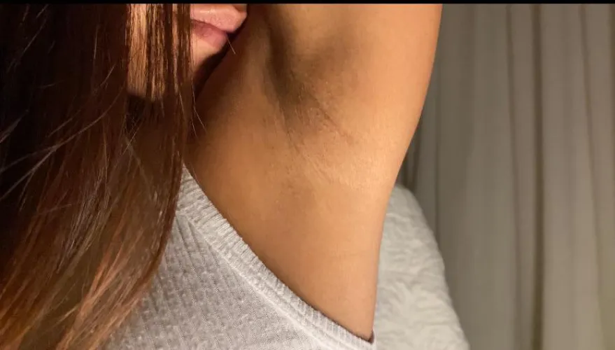 Say YES if you are willing to do anything for them