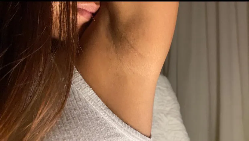 Say YES if you are willing to do anything for them