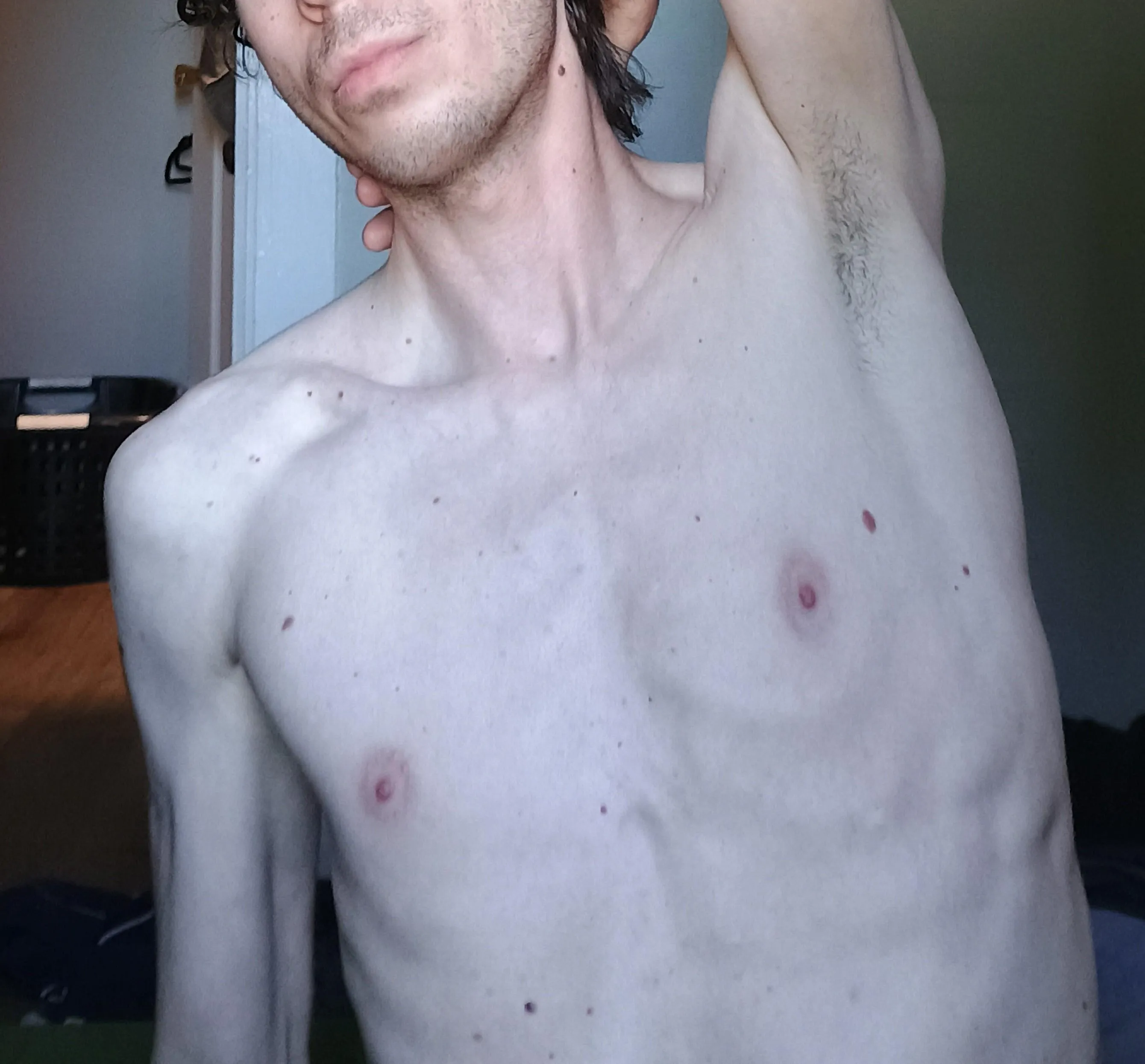 Post hike pits. Keep the hair growing or keep trimming?