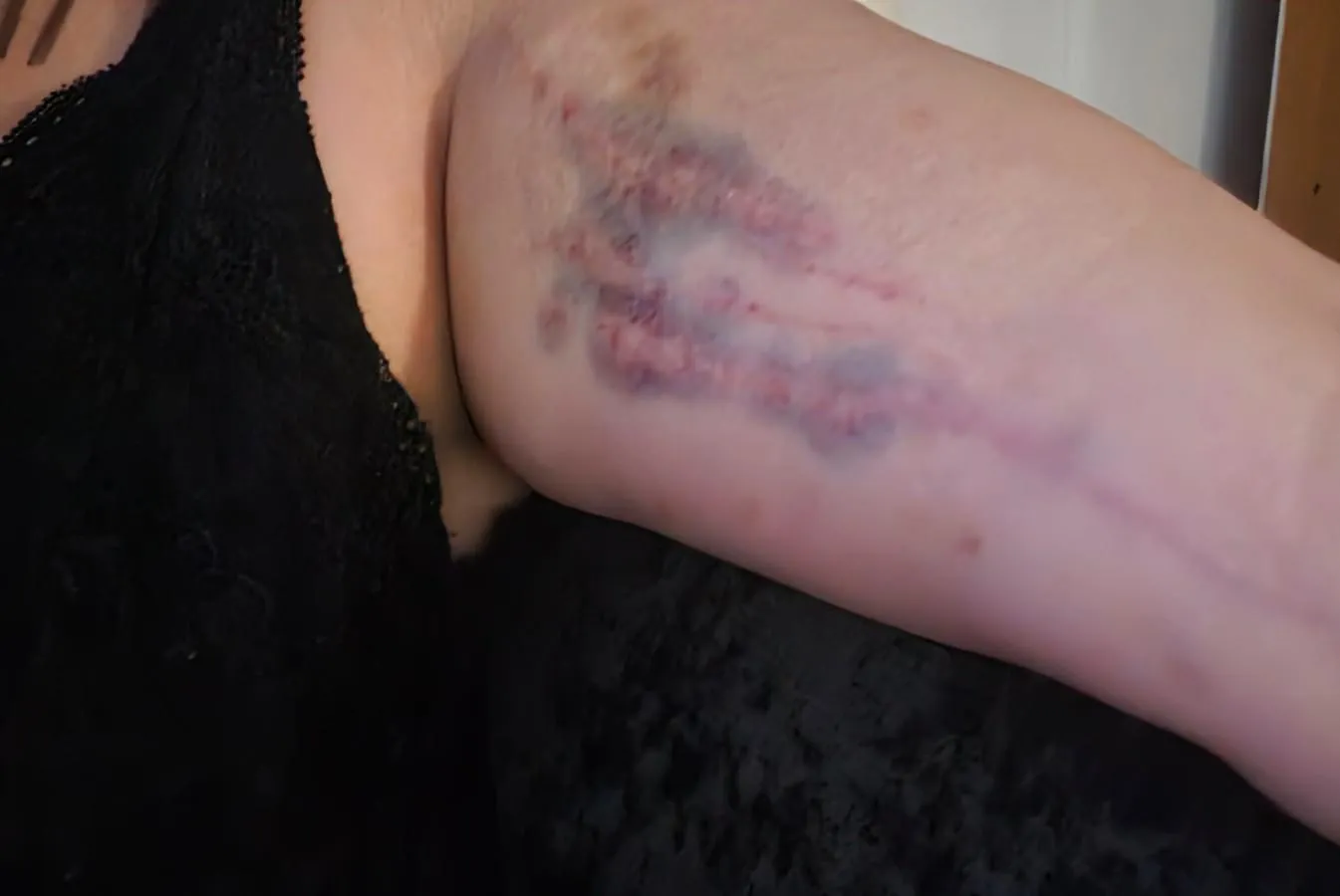 Take a guess what caused this?