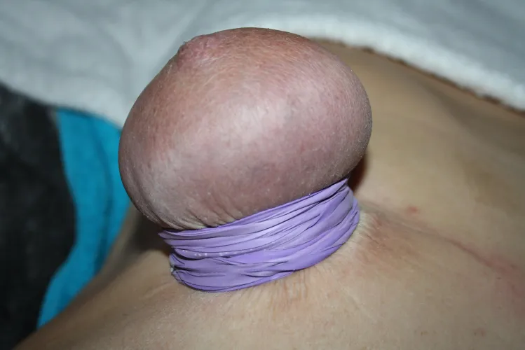 50 RUBBER BANDS - PURPLE TITS LOOK LIKE MUSHROOMS!