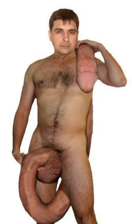 Doctor said it might get a little... inflated 😁😁