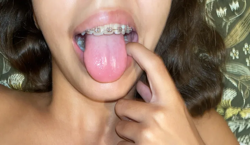 Let me make your Night with These pink braces and pink lips