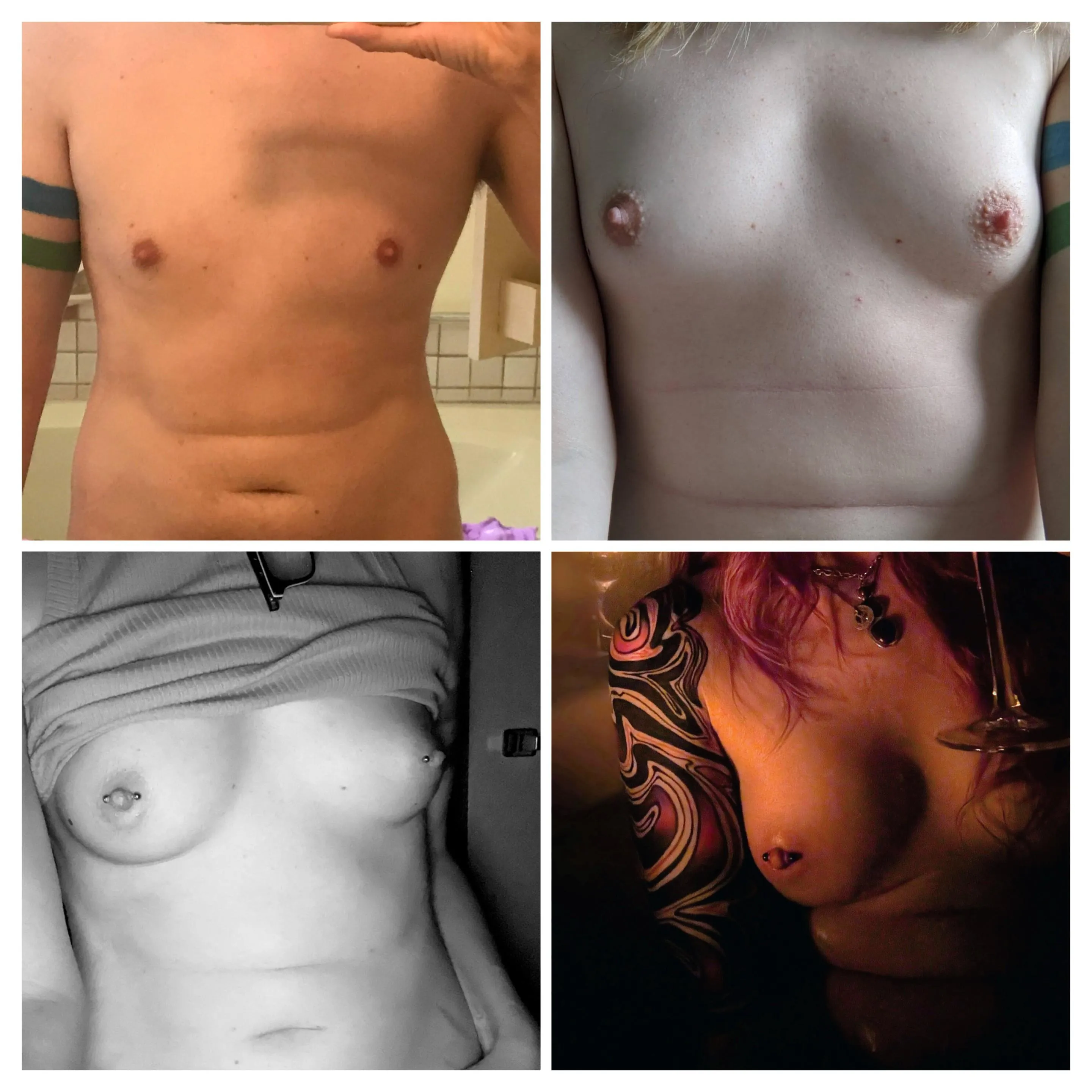 PreHRT vs 1, 3, and 5 years HRT. So happy. 🥰