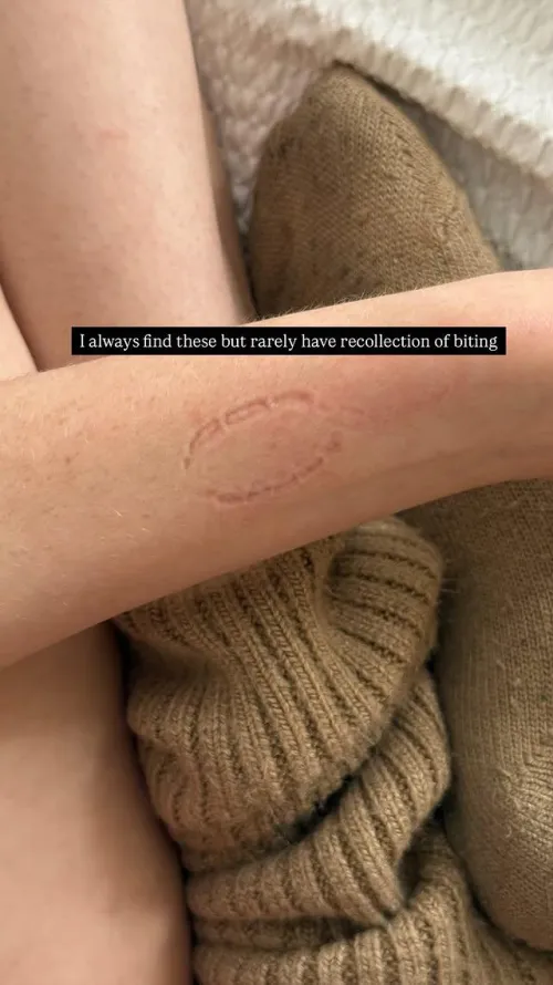 What I get from this is Dodie likes to be bitten