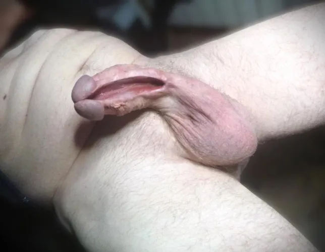 End of healing ( hard )