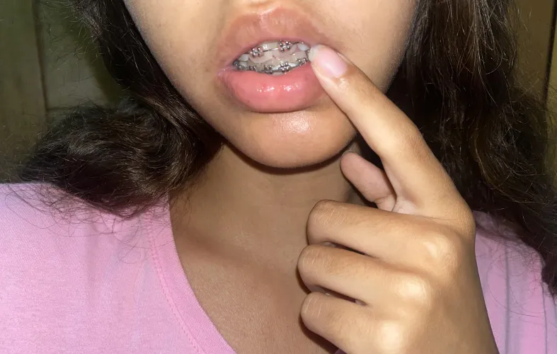 Should I put lipgloss in today?