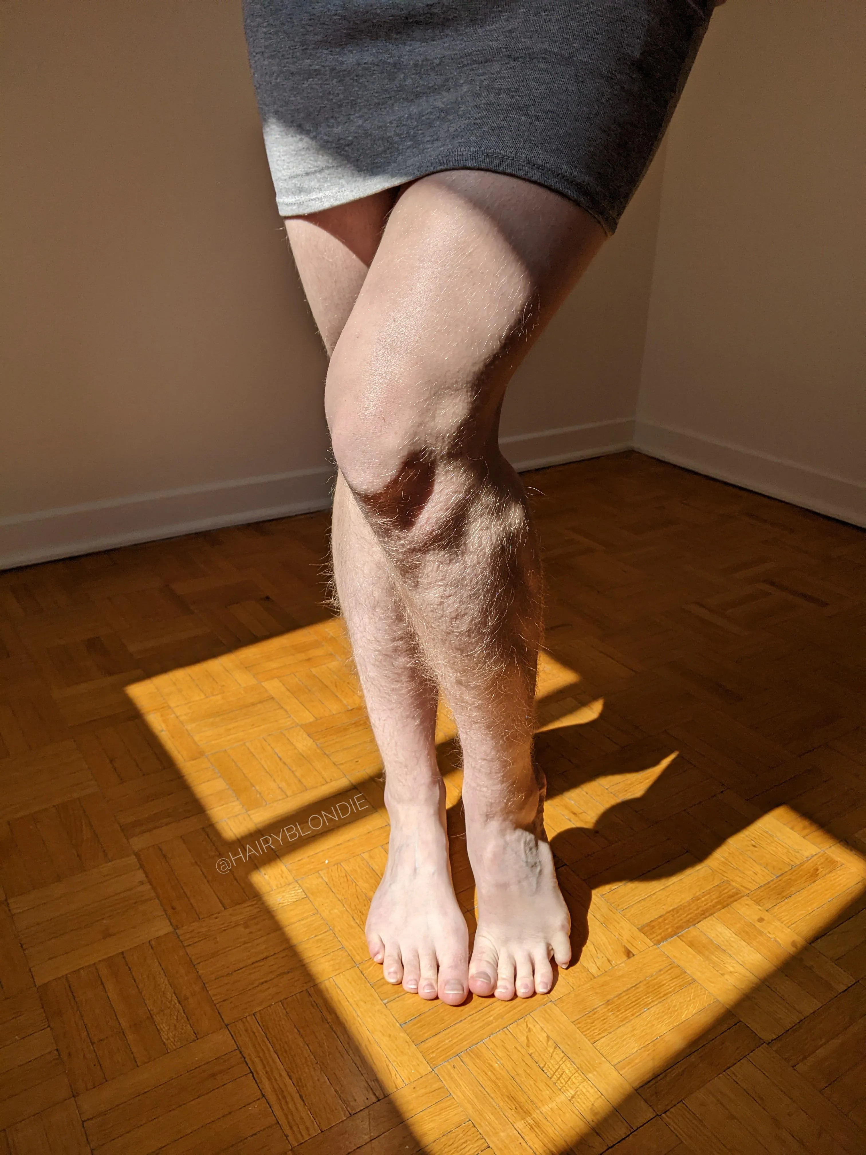 No polish toes and legs full of hair