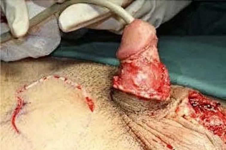 Small cock punishment? 😈❤️