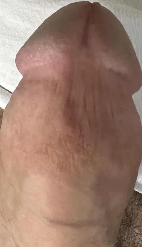 Is this complete removal?