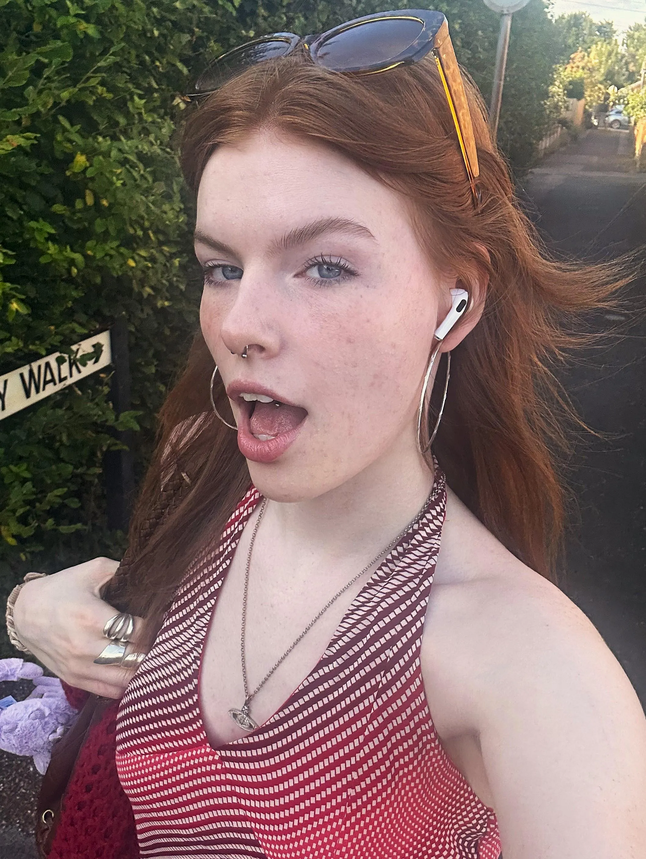 Am I cute with natural freckles?