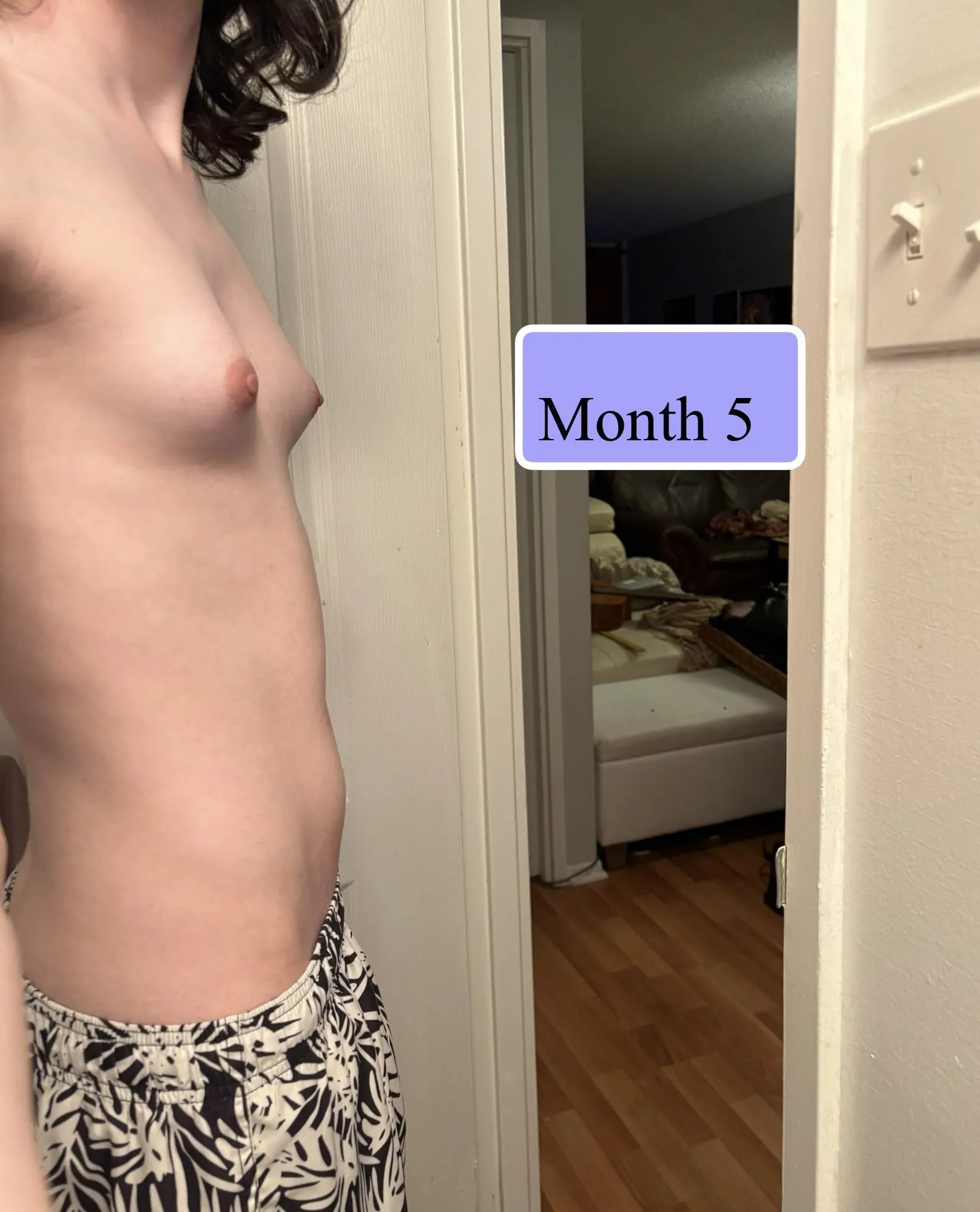 Can Tanner stage be deduce simply by look ?