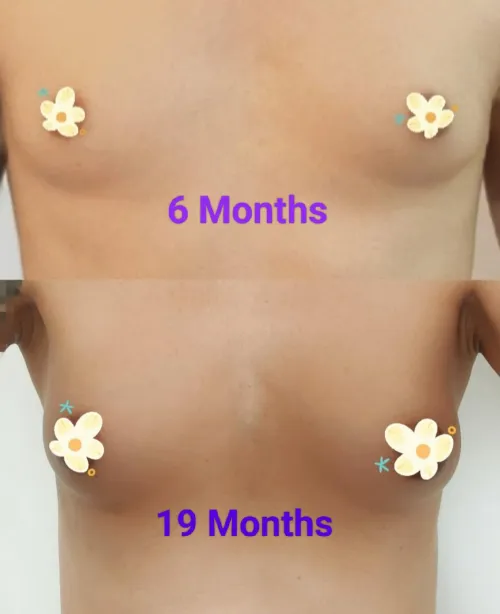 My HRT Journey: 19 Months of Change, Growth & Joy