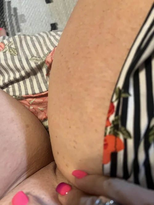 Pick your favorite freckle and let me know